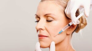 Collagen stimulation injection on lower face