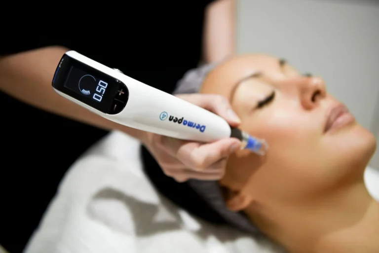 Dermapen Microneedling