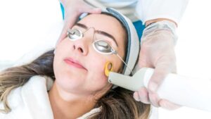 Laser treatments for face